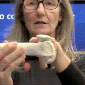 Exercício e condromalácia