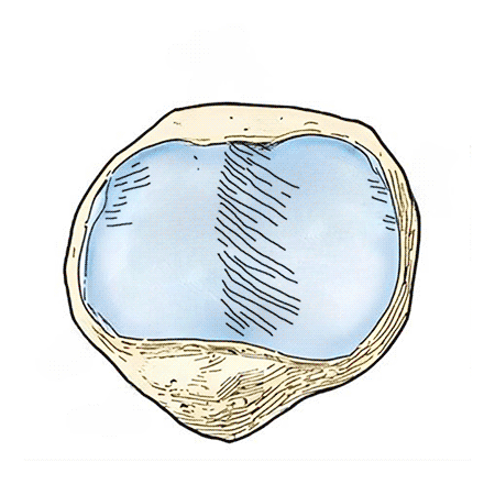 Relação Patela Tróclea com foco na patela